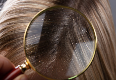 Which Medicated Anti-Dandruff Shampoo Works Best?